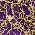 Image for Leptospirosis