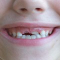 Image for Oral health of children